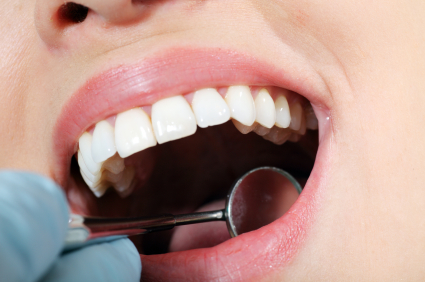 Dental Implants or Dental Bridge?