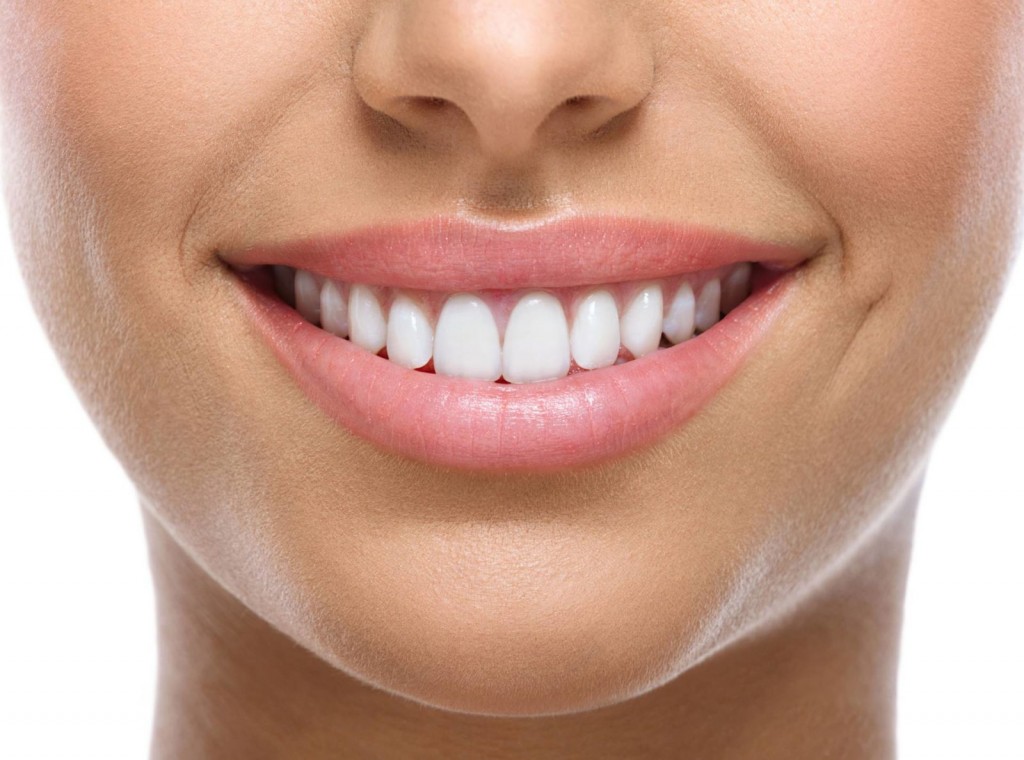 teeth-whitening-birmingham